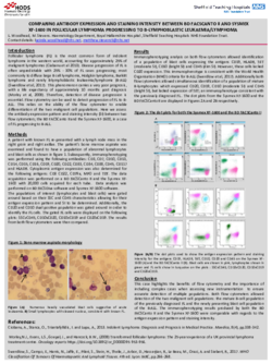 Comparing antibody expression and staining intensity between BD FACSCANTO II and Sysmex XF-1600 in Follicular Lymphoma progressing to B-Lymphoblastic leukaemia/lymphoma