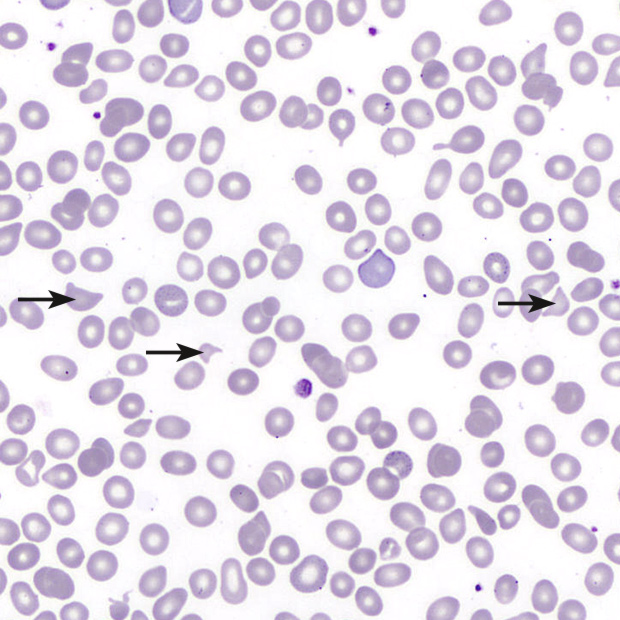 [.SE-se Sweden (swedish)] Microspcope