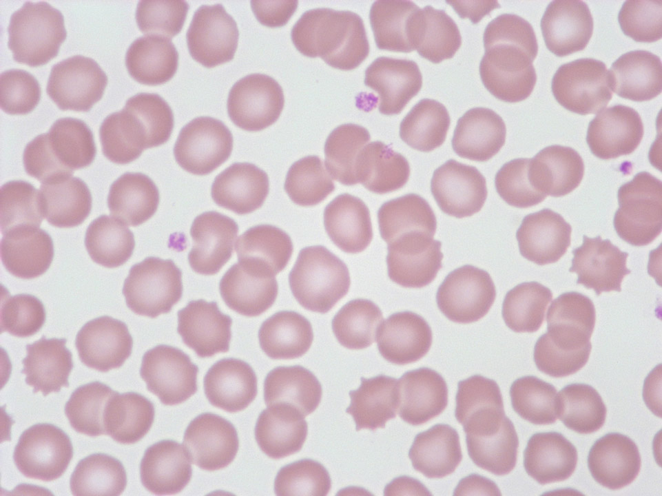 Echinocytes