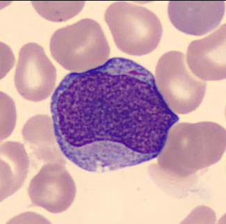 myeloblast