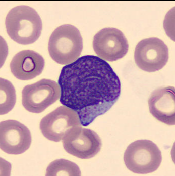 Granulated myeloblast 1